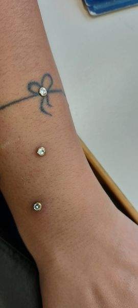 Microdermals am Unterarm in Diamantoptik
